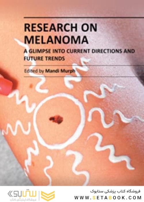 Research on Melanoma : A Glimpse into Current Directions and Future Trends2011