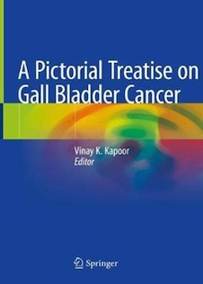 عکس A Pictorial Treatise on Gall Bladder Cance2021رساله تصویری درباره سرطان کیسه صفرا