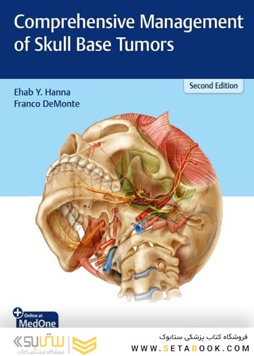 Comprehensive Management of Skull Base Tumors, Second Edition2021