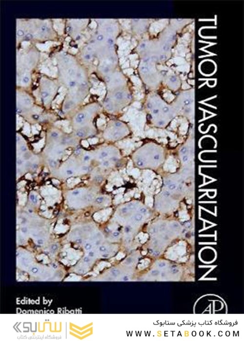 Tumor Vascularization