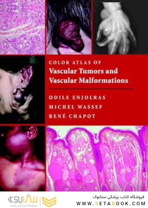Color Atlas of Vascular Tumors and Vascular Malformations 1st Edicion 2007