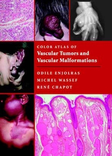 عکس Color Atlas of Vascular Tumors and Vascular Malformations 1st Edicion 2007
