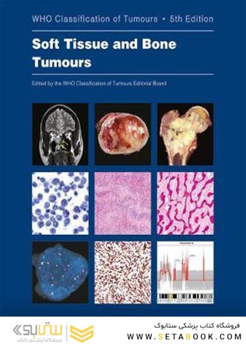 WHO classification of tumours of soft tissue and bone tumours 2020