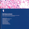 WHO classification of tumours of soft tissue and bone tumours 2020