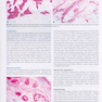 WHO classification of tumours of soft tissue and bone tumours 2020