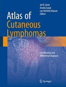 عکس Atlas of Cutaneous Lymphomas : Classification and Differential Diagnosis2015اطلس لنفوم های جلدی: طبقه بندی و تشخیص افتراقی