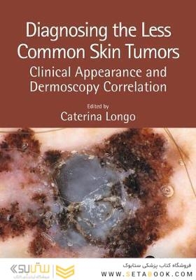 Diagnosing the Less Common Skin Tumors : Clinical Appearance and Dermoscopy Correlation2019