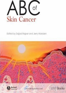 عکس ABC of Skin Cancer سرطان پوست