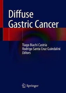 عکس Diffuse Gastric Cancer2018سرطان معده