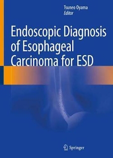 عکس Endoscopic Diagnosis of Esophageal Carcinoma for ESD