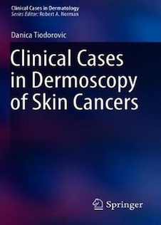 عکس Clinical Cases in Dermoscopy of Skin Cancersموارد بالینی درموسکوپی سرطانهای پوست
