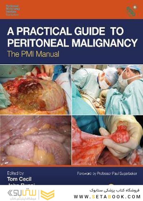 A Practical Guide to Peritoneal Malignancy : The PMI Manual