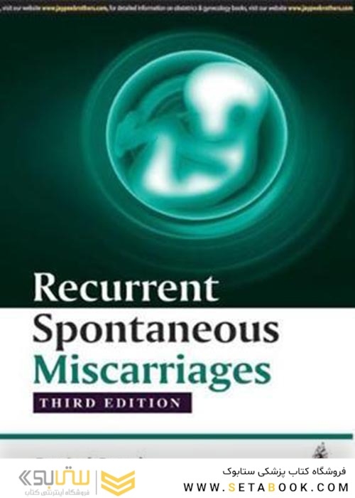 Recurrent Spontaneous Miscarriagesسقط های خود به خودی مکرر