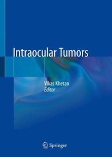 عکس Intraocular Tumorsتومورهای داخل چشمی