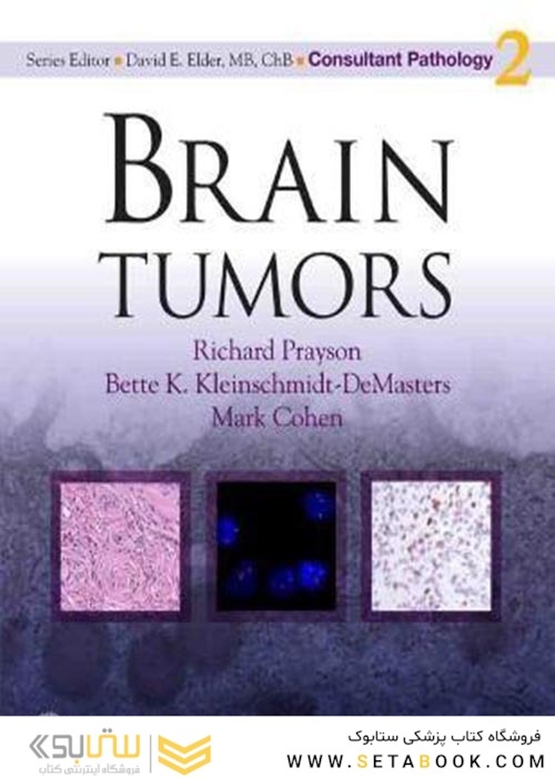 Brain Tumors2010
