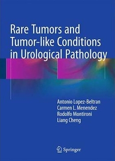 عکس Rare Tumors and Tumor-like Conditions in Urological Pathologyتومورهای نادر و شرایط مشابه تومور در آسیب شناسی اورولوژی