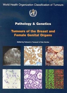 عکس Pathology and Genetics of Tumours of the Breast and Female Genital Organs2003