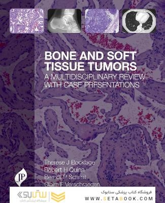 Bone and Soft Tissue Tumors : A Multidisciplinary Review with Case Presentationsتومورهای بافت استخوانی و نرم: یک بررسی چند رشته ای با ارائه موارد