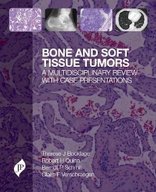 عکس Bone and Soft Tissue Tumors : A Multidisciplinary Review with Case Presentationsتومورهای بافت استخوانی و نرم: یک بررسی چند رشته ای با ارائه موارد