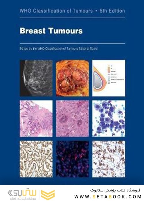 WHO Classification of Breast Tumours : WHO Classification of Tumours, Volume 2