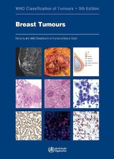عکس WHO Classification of Breast Tumours : WHO Classification of Tumours, Volume 2