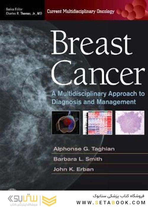 Breast Cancer : A Multidisciplinary Approach to Diagnosis and Managementسرطان پستان: رویکرد چندرشته ای در تشخیص و مدیریت