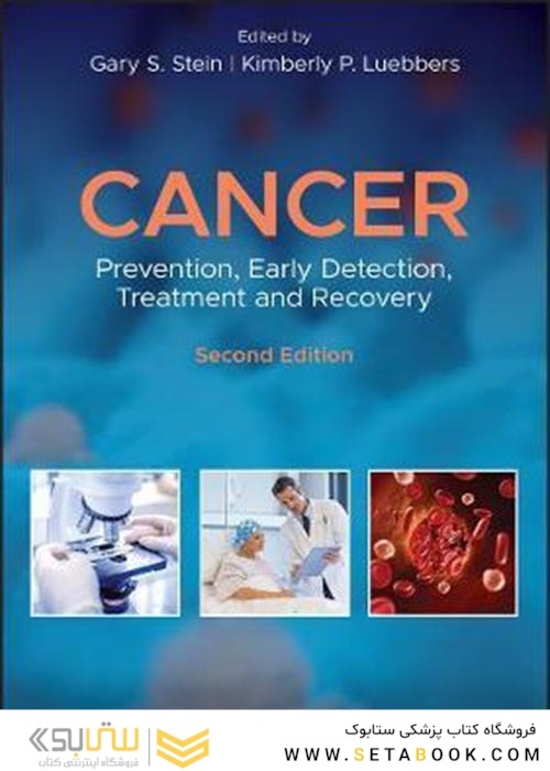 Cancer : Prevention, Early Detection, Treatment and Recoveryسرطان: پیشگیری ، تشخیص زودهنگام ، درمان و بهبود