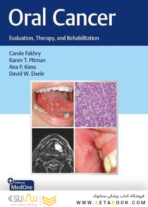 Oral Cancer : Evaluation, Therapy, and Rehabilitationسرطان دهان: ارزیابی ، درمان و توانبخشی