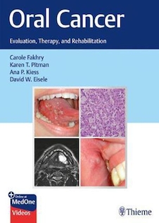 عکس Oral Cancer : Evaluation, Therapy, and Rehabilitationسرطان دهان: ارزیابی ، درمان و توانبخشی