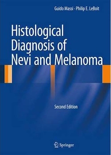 عکس Histological Diagnosis of Nevi and Melanomaتشخیص بافتی خال ها و ملانوم