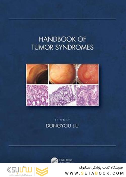 Handbook of Tumor Syndromesکتاب سندرم های توموری