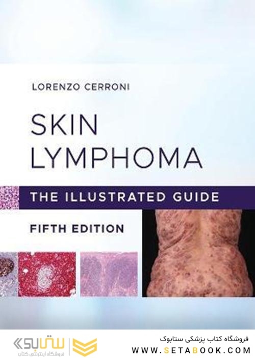 Skin Lymphoma : The Illustrated Guideلنفوم پوستی: راهنمای مصور
