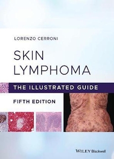 عکس Skin Lymphoma : The Illustrated Guideلنفوم پوستی: راهنمای مصور