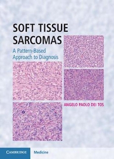 عکس Soft Tissue Sarcomas Hardback with Online Resource : A Pattern-Based Approach to Diagnosisسارکومهای بافت نرم