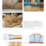 Atlas of Abdominoplasty