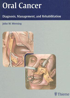 عکس سرطان دهان