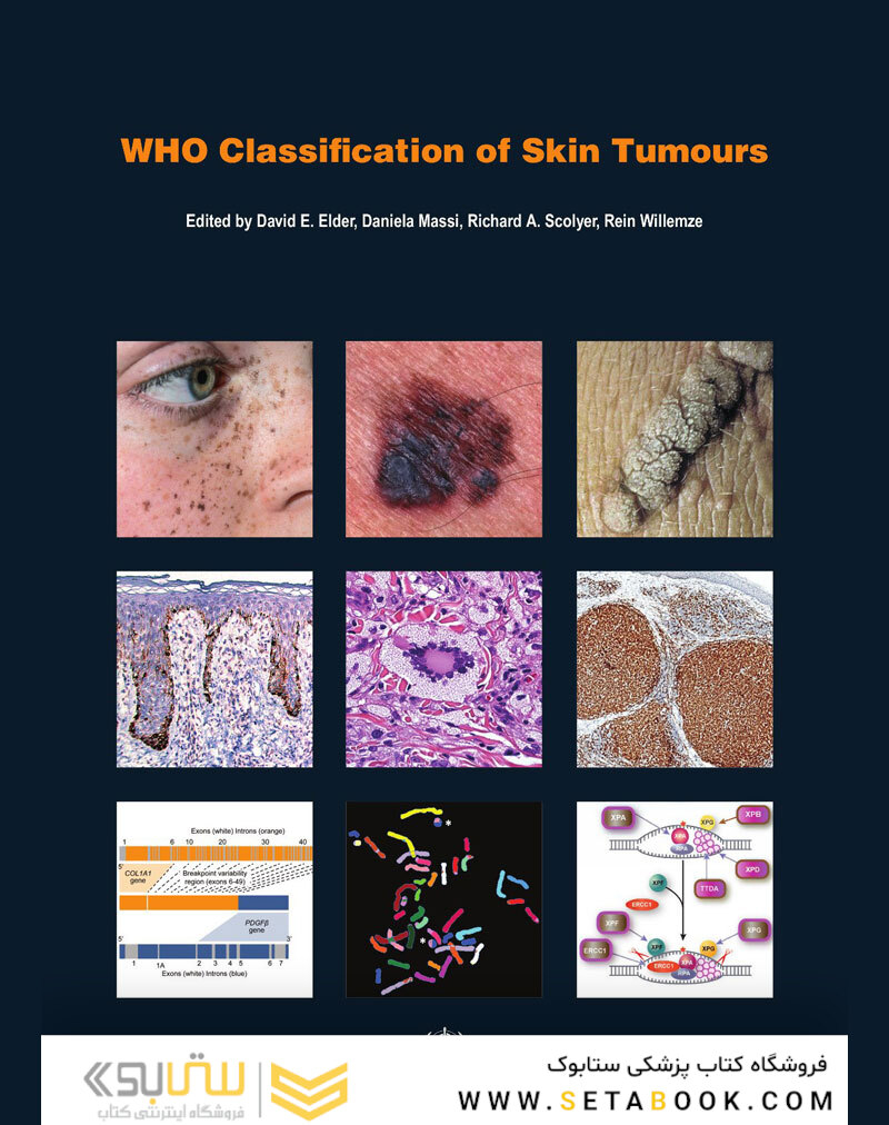 WHO Classification of Skin Tumours : WHO Classification of Tumours, Volume 11