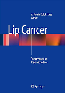 عکس Lip Cancer : Treatment and Reconstruction
