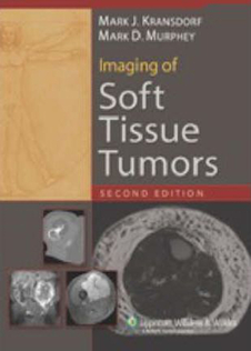 عکس تصویربرداری تومورهای بافت نرم