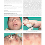 Color Atlas & Synopsis of Pediatric Dermatology 2021