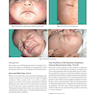 Color Atlas & Synopsis of Pediatric Dermatology 2021