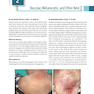 Color Atlas & Synopsis of Pediatric Dermatology 2021