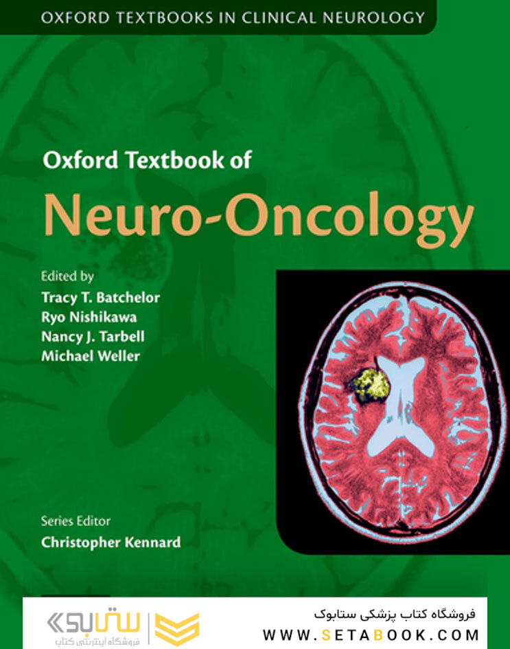 Oxford Textbook of Neuro-Oncology