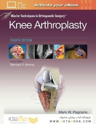 Master Techniques in Orthopedic Surgery: Knee Arthroplasty2019