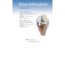 Master Techniques in Orthopedic Surgery: Knee Arthroplasty2019