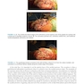 Master Techniques in Orthopedic Surgery: Knee Arthroplasty2019