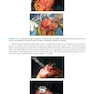 Master Techniques in Orthopedic Surgery: Knee Arthroplasty2019