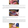 Master Techniques in Orthopedic Surgery: Knee Arthroplasty2019