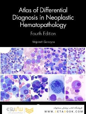 Atlas of Differential Diagnosis in Neoplastic Hematopathology2021
