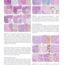 Atlas of Differential Diagnosis in Neoplastic Hematopathology2021